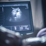 I Lost a Child to Miscarriage. New York Times Essay Likening Miscarriage to Abortion Is Despicable.