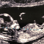 EXCLUSIVE: GOP Lawmakers Demand FDA Explain Inaccurate Prenatal Tests Following Damning Report